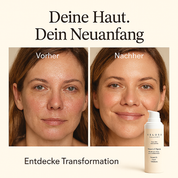 Velora Essence Vitamin C Serum – Für sichtbar strahlendere Haut in wenigen Tagen