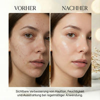 Vitamin C Serum – Your skin in new radiance