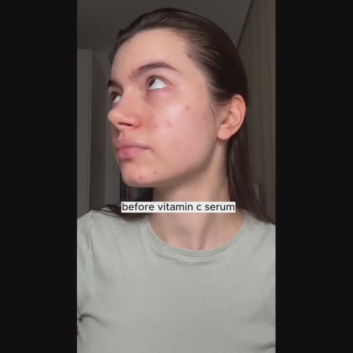 Velora Essence Vitamin C Serum – Für sichtbar strahlendere Haut in wenigen Tagen
